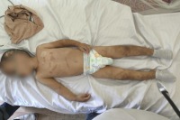 Ağdamda dəhşət: valideynləri uşağı döyüb komaya saldı – Bakıya gətirildi