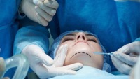 Plastik cərrahlara rüşvətlə sertifikasiya verən vəzifəli şəxslər - Adlar AÇIQLANDI