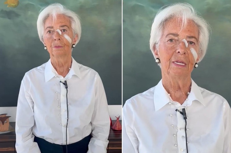 Kristin Laqardın üzündəki sarğıların sirri açıldı